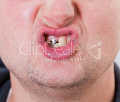 Young man face with tooth pin