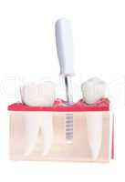 Implant dental model