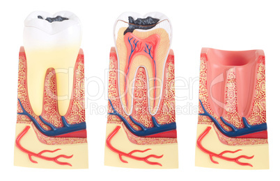 Tooth anatomy