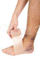 Bandaging a sprained ankle