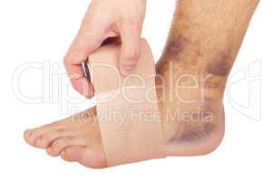 Bandaging a sprained ankle