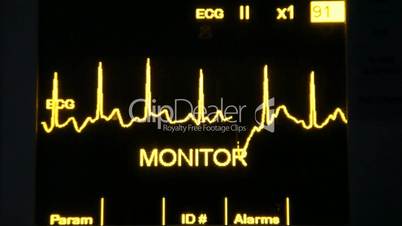 actual EKG monitor