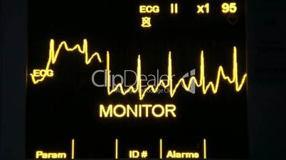 actual EKG monitor slowmotion