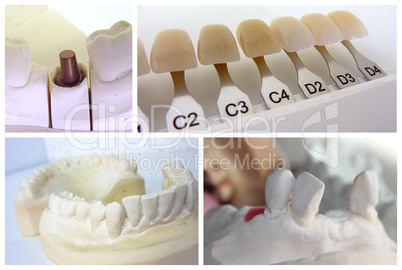 Dental technician objects