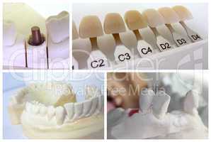 Dental technician objects