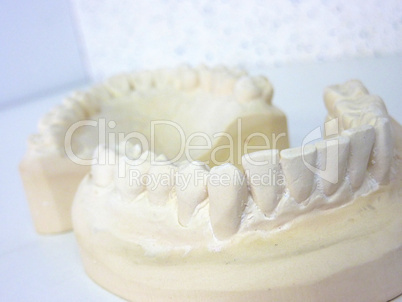 Plaster teeth