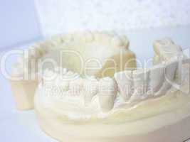 Plaster teeth