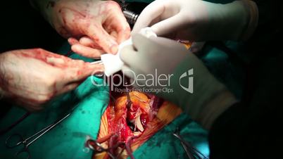 surgical series 14