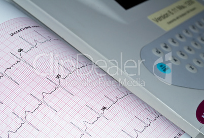 Electrocardiogram.