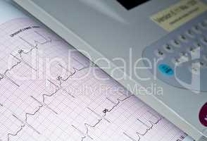 Electrocardiogram.