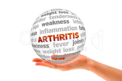 Arthritis