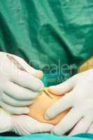 Close up of a surgeon holding a scalpel