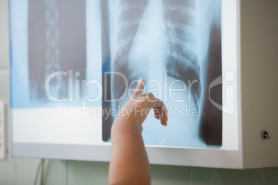 Close up of people showing a X-ray