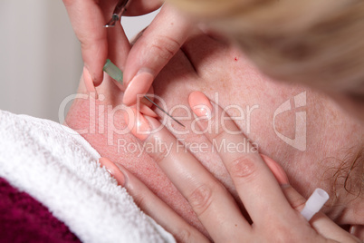 Kosmetikbehandlung Hautunreinheiten beseitigen - Cosmetic treatment to eliminate skin blemishes