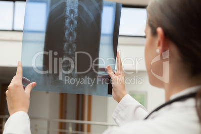 Female doctor holding up x-ray