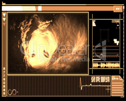 Orange and black digital interface showing vein interior