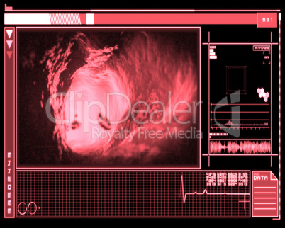 Pink and black digital interface showing vein interior