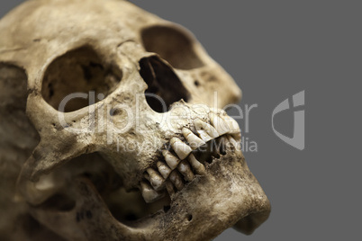 Human skull bone