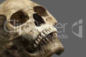 Human skull bone