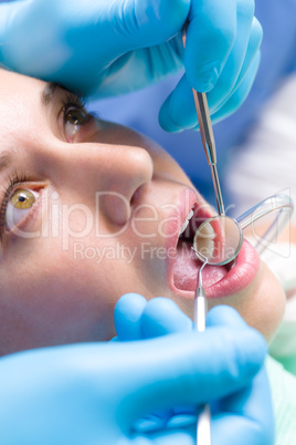 Dentist surgery closeup of woman's open mouth