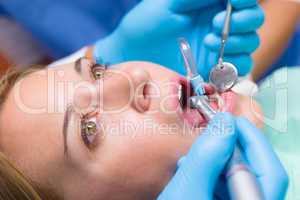 Close-up woman's mouth dental tools treatment