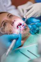 Teeth check-up open mouth and dental tools