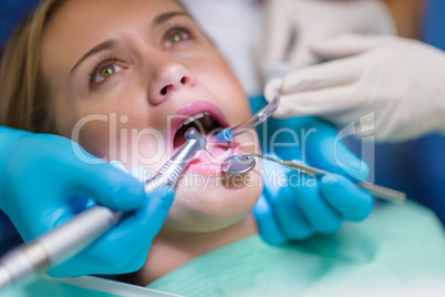 Scared patient at dentist office closeup mouth