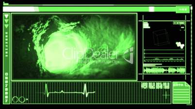 Digital interface showing bloodflow through vein