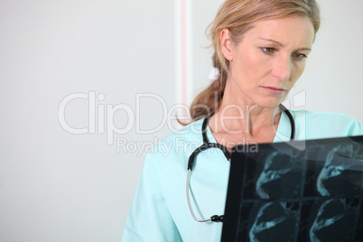 Nurse looking at X-ray