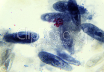 Paramecium under the microscope, background