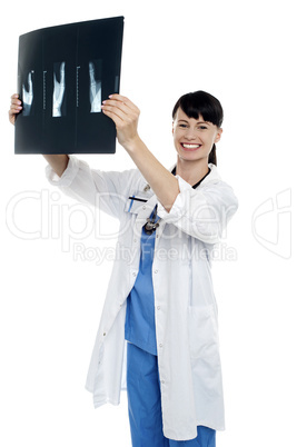 Young surgeon holding x-ray sheet of a patient