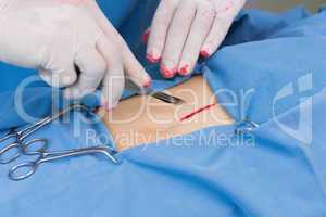 Surgeon incising a patient stomach