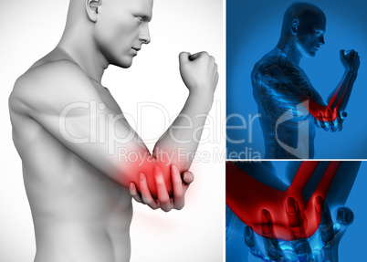 Three images of elbow pain