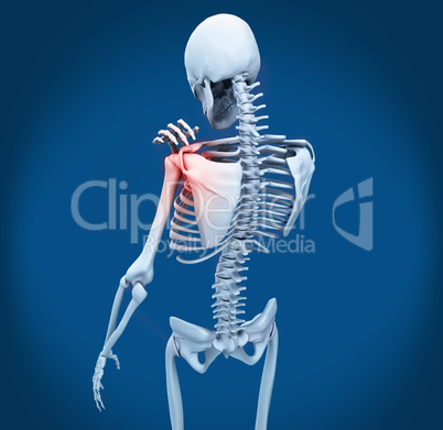 Shoulder pain on skeleton