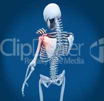 Shoulder pain on skeleton