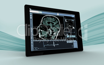 Digital tablet showing brain interface