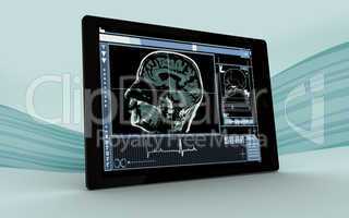Digital tablet showing brain interface