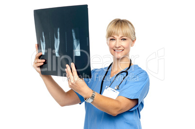Lady surgeon holding up x-ray report