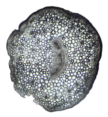 Kalanchoe under the microscope, background. (Kalanchoe)