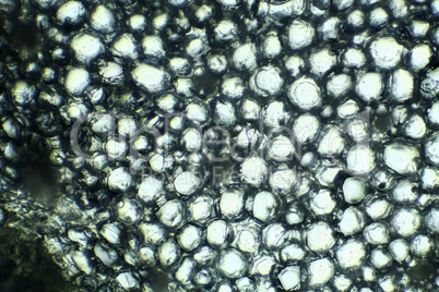 Kalanchoe under the microscope, background. (Kalanchoe)