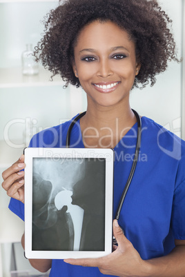 African American Woman Doctor X-Ray Tablet Computer