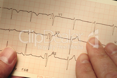 Closeup of electrocardiogram printout being held