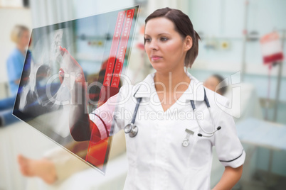 Nurse pressing on screen showing pelvic x-ray