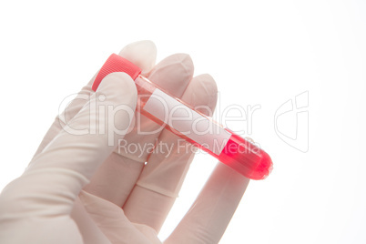 Hand in glove holding vial of blood