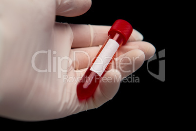 Gloved hand holding vial of blood