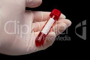 Gloved hand holding vial of blood