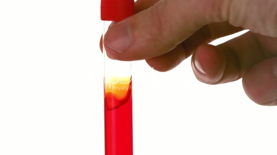 Hand swirling test tube of blood