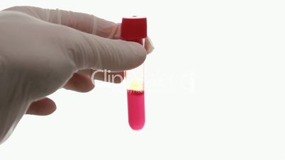 Hand holding vial of blood