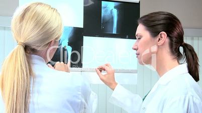 Female Technicians Examining X-Ray Scans
