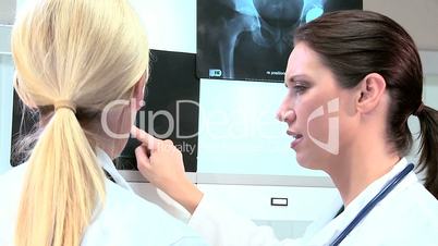 Young Female Doctors Looking at X-Rays